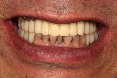 76e2271bd5301dbda9571d48a25beae6_1591085547_2.jpg